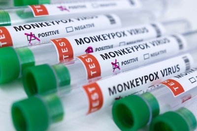 ЕС купува 110 000 дози ваксини срещу маймунската шарка