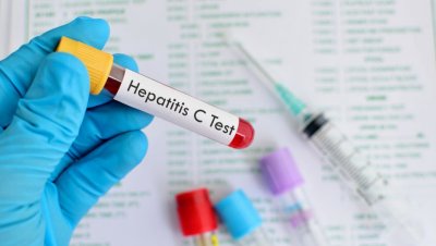 Гражданите ще могат да се изследват за хепатит C безплатно