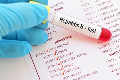 МЗ повежда безплатна кампания за тестване за хепатити 