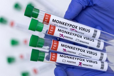 Над 1000 заразени с маймунска шарка в САЩ само за ден