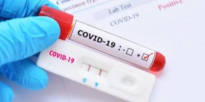 1496 са новите случаи на COVID 19 у нас регистрирани за последното