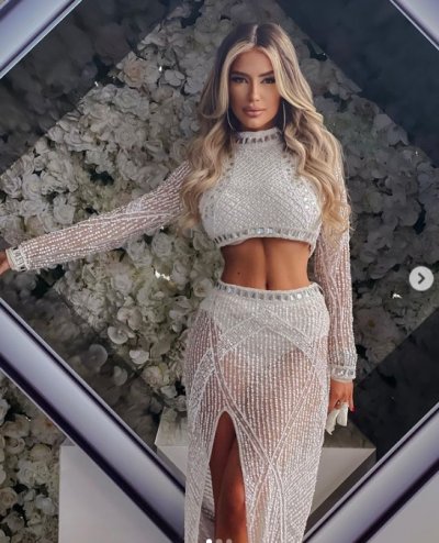 Певицата Тита потвърди със снимки новината че е пребита от