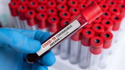 563 са новите случаи на коронавирус у нас за последното
