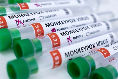 Египетските власти установиха втори случай на маймунска шарка Вирусът е