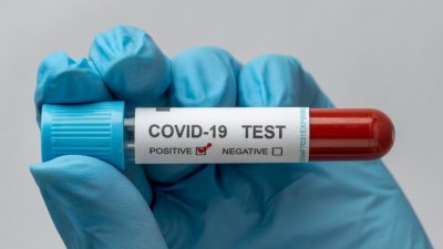 14% са положителните тестове за COVID-19 у нас