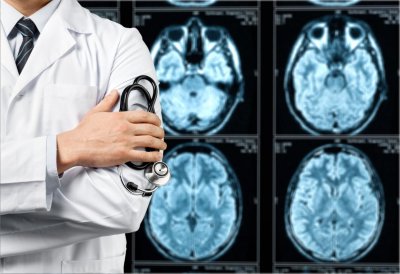 35 000 случая на мозъчен инсулт регистрират у нас годишно