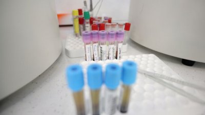 Новите регистрирани случаи с коронавирус през последното денонощие в България