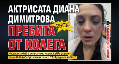 ЗВЕРСТВО: Актрисата Диана Димитрова пребита от колега (Ужасяващи Снимки)