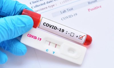 4 починаха у нас с диагноза COVID-19