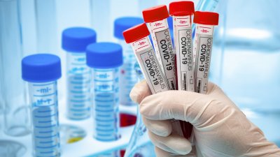 167 са новите случаи на коронавирус потвъдени при направени 4 037