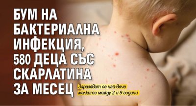 Бум на бактериална инфекция, 580 деца със скарлатина за месец