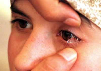Момче в Армения плаче кристали, лекарите в шок
