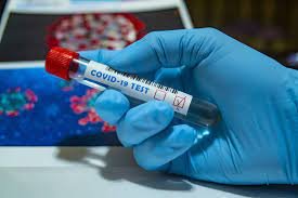 31 са новите потвърдени случаи на зараза с Ковид 19 в