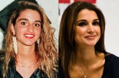 Вижте кралица Рания преди и след пластичните операции