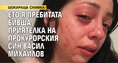 18+ ШОК СНИМКА! Ето я пребитата бивша приятелка на прокурорския син Васил Михайлов
