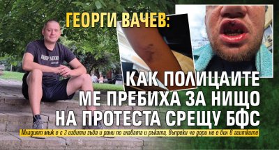 Георги Вачев: Как полицаите ме пребиха за нищо на протеста срещу БФС