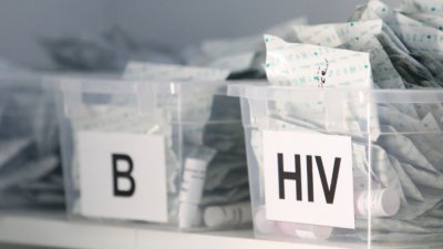 Половината от случаите с ХИВ в ЕС са диагностицирани късно
