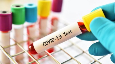 118 души се заразиха с COVID-19, двама починаха 
