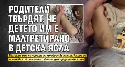 Родители твърдят, че детето им е малтретирано в детска ясла