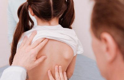 20 процента от децата у нас имат гръбначно изкривяване Според