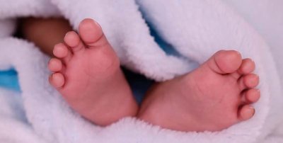 Трагедия! Бебе без лице се роди в Португалия
