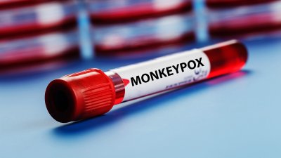 В Конго обявиха епидемия от маймунска шарка