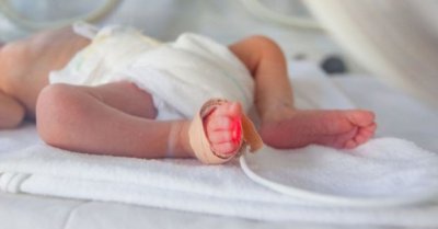 Лекари спасиха новородено бебе на 22 дни с коклюш и тежки