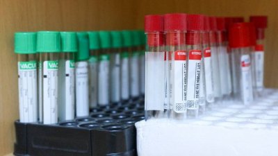 МС задели още 1 млн. лв. за ваксини срещу коклюш