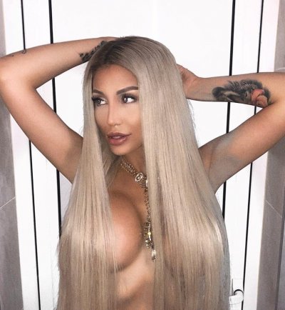 Близки на силиконката Джулиана Гани са сериозно притеснени за здравето