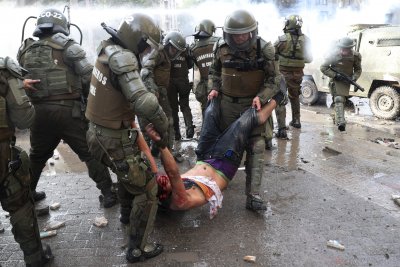 Стотици ослепяха при протестите в Чили (СНИМКИ)