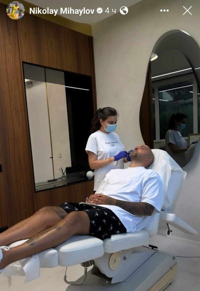 Ники Михайлов си сложи ботокс 36 годишният вратар реши да се