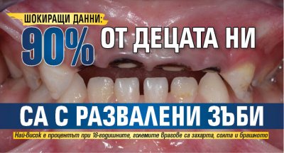 ШОКИРАЩИ ДАННИ: 90% от децата ни са с развалени зъби