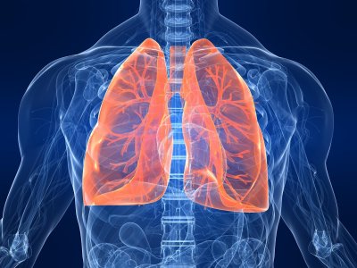 Бум на рак на белия дроб по целия свят