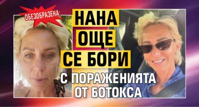 Обезобразена: Нана още се бори с пораженията от ботокса