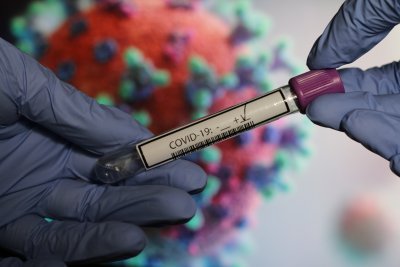 Какви са симптомите на новия COVID-19