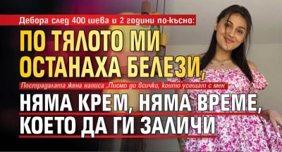 Дебора след 400 шева и 2 години по-късно: По тялото ми останаха белези, няма крем, няма време, което да ги заличи