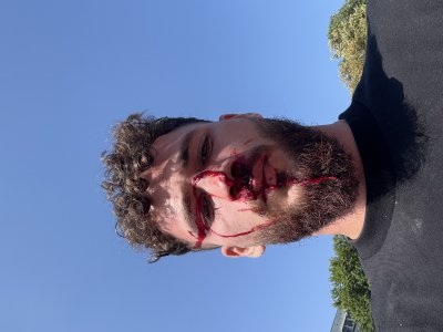 Само в Lupa.bg: Размазаха от бой студент-богослов заради жена (СНИМКИ 18+)
