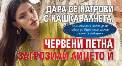 Дара се натрови с кашкавалчета, червени петна загрозили лицето й 