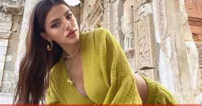 Дара се натровила с кашкавалчета, червени петна избили по лицето й 