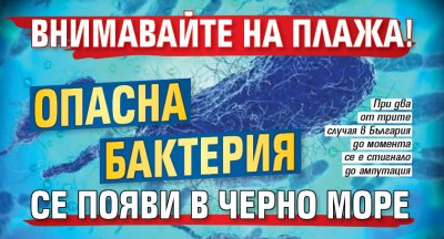 Внимавайте на плажа! Опасна бактерия се появи в Черно море