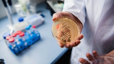 СЗО обяви смъртоносна гъбична инфекция за заплаха за човечеството