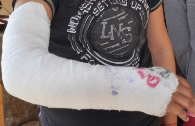 17-годишен скри наркотик в гипса на дясната си ръка