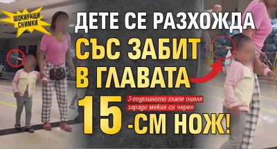 ШОКИРАЩИ СНИМКИ: Дете се разхожда със забит в главата 15-см нож!