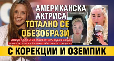 Американска актриса тотално се обезобрази с корекции и Оземпик