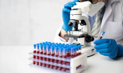 Разкриха метод за спиране на развитието на рака на кръвта