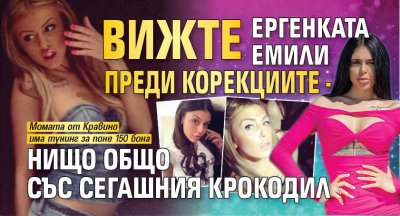 Вижте ергенката Емили преди корекциите - нищо общо със сегашния крокодил (ХИТ СНИМКИ)