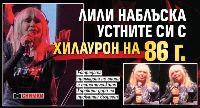 Лили наблъска устните си с хилаурон на 86 г. (снимки)
