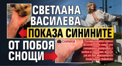 Светлана Василева показа синините от побоя (СНИМКИ)
