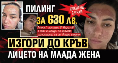 ШОКИРАЩ СЛУЧАЙ: Пилинг за 630 лв. изгори до кръв лицето на млада жена
