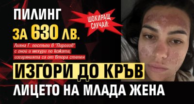 ШОКИРАЩ СЛУЧАЙ: Пилинг за 630 лв. изгори до кръв лицето на млада жена